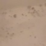 Problem sa pojavljivanjem buđi